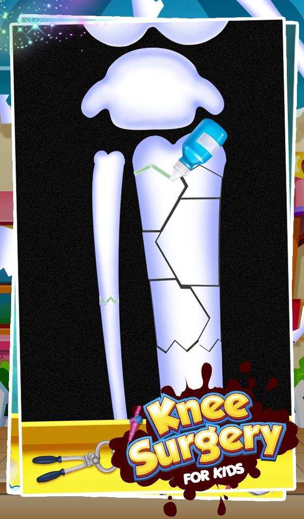 Knee Surgery For Kids