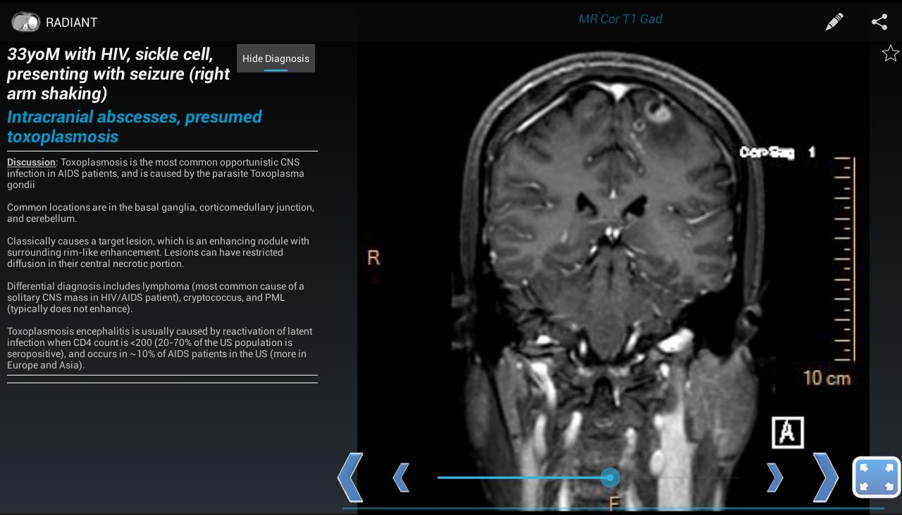 RADIANT: Share Radiology Cases