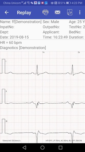 aECG