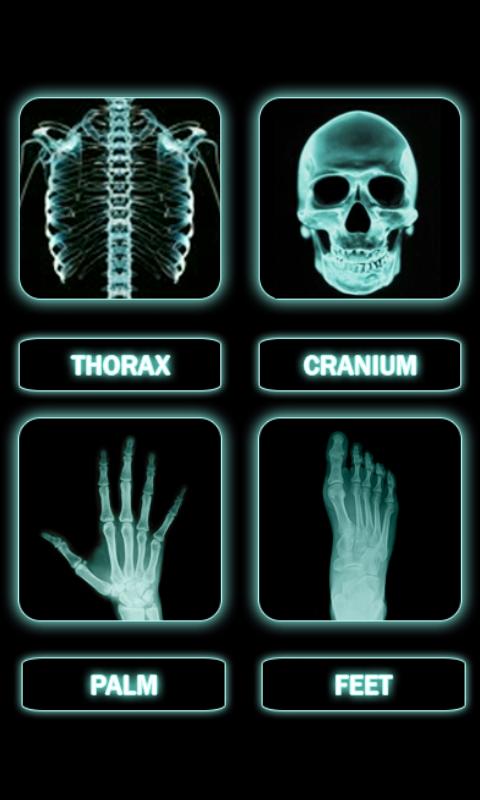 Candy X-Ray :Prank